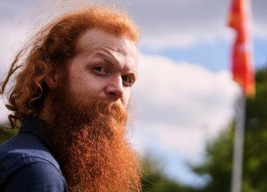 The red hair gene may hold the key to healing wounds