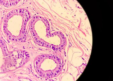 The painful and widely misunderstood skin condition that can hide in plain sight